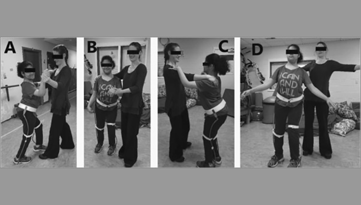 Informal Dance Intervention Improves BMI and Functional Gait in an Adolescent With Cerebral Palsy