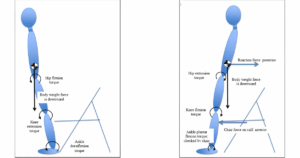 Intervention for an Adolescent With Cerebral Palsy During Period of Accelerated Growth - blog post image